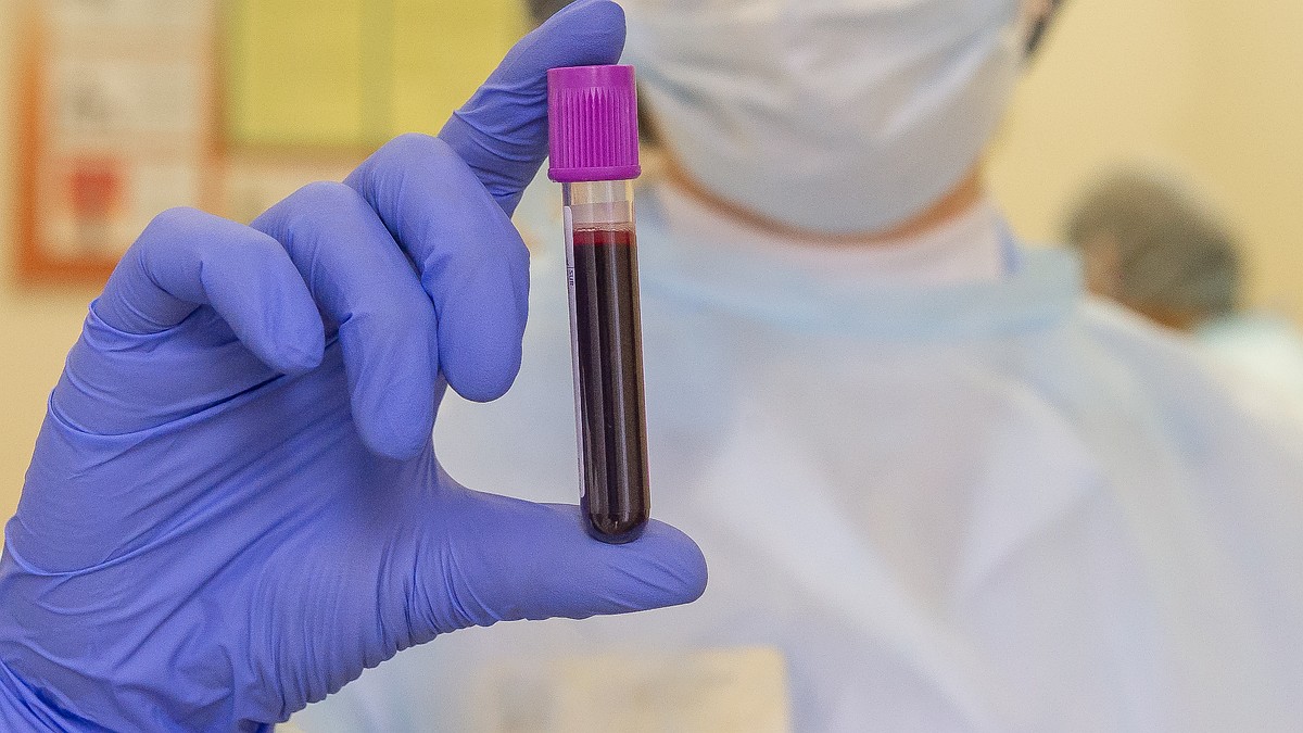 Антитела к коронавирусу: как определить